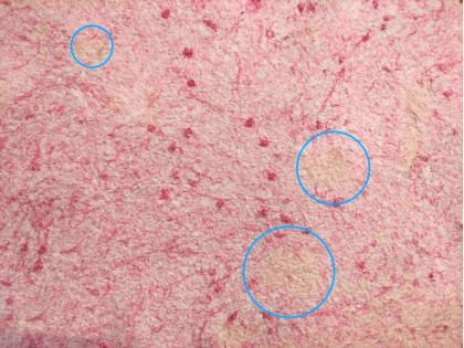 На жидких обоях появились желтые пятна? Что делать?