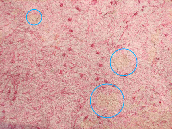 На жидких обоях появились желтые пятна? Что делать? На жидких обоях появились желтые пятна? Что делать?